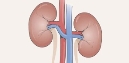 Нефроптоз (зміщення, опущення нирки) ⚕️ Лікування у Дніпрі ⋮ MEDICAL PLAZA